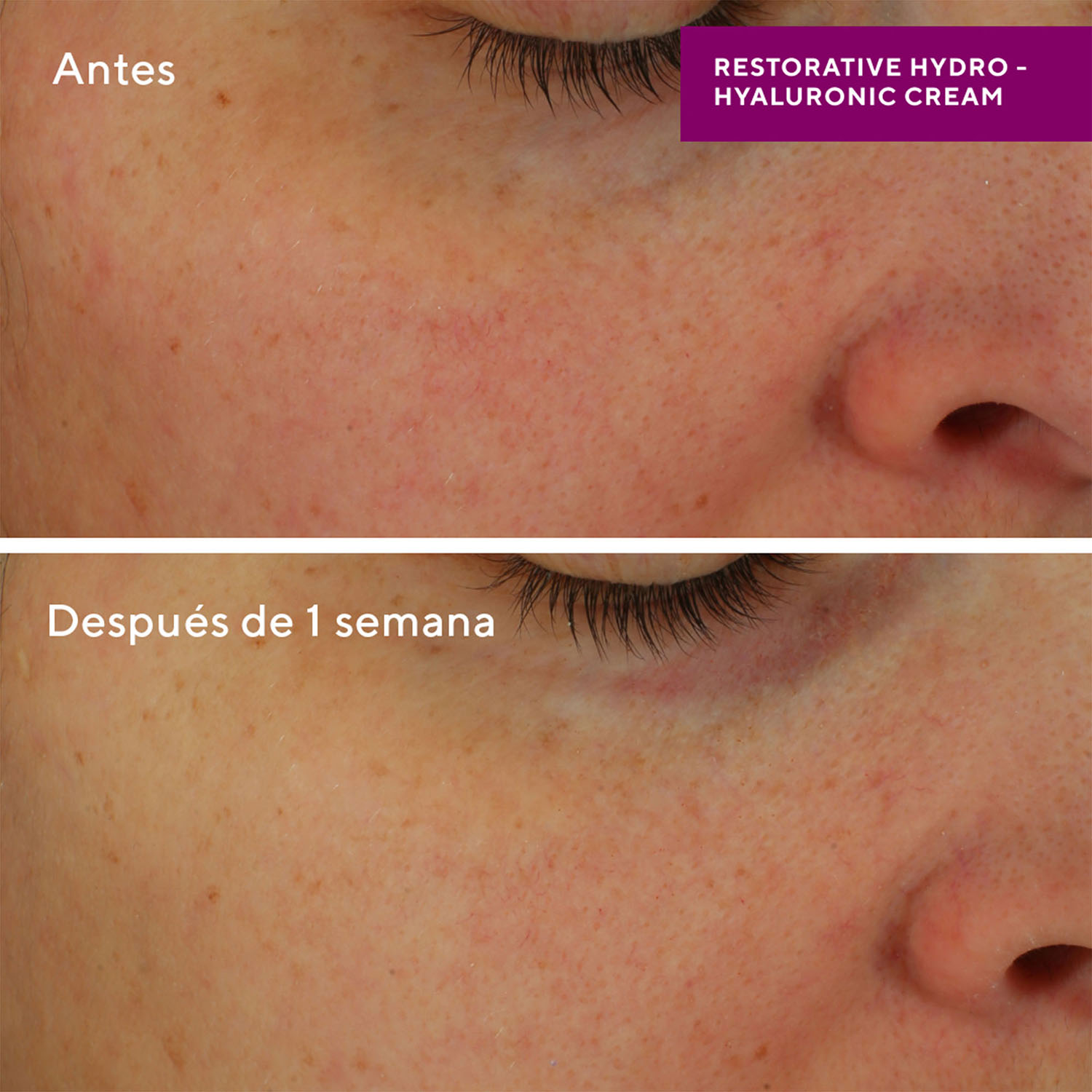 RESTORATIVE HYDRO-HYALURONIC CREAM (CREMA RESTAURADORA HIDRO-HIALURÓNICA)